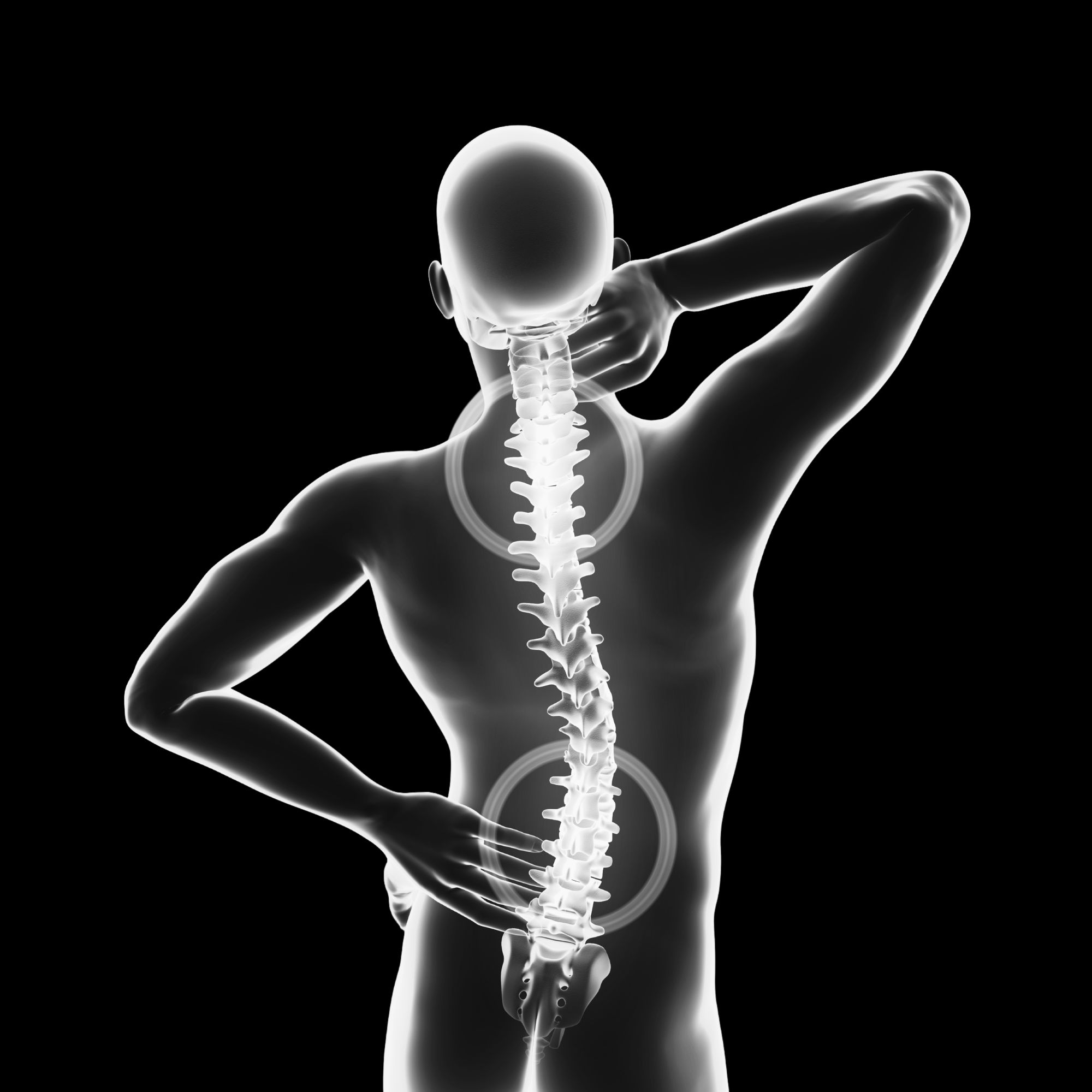 Spine and back pain medical image