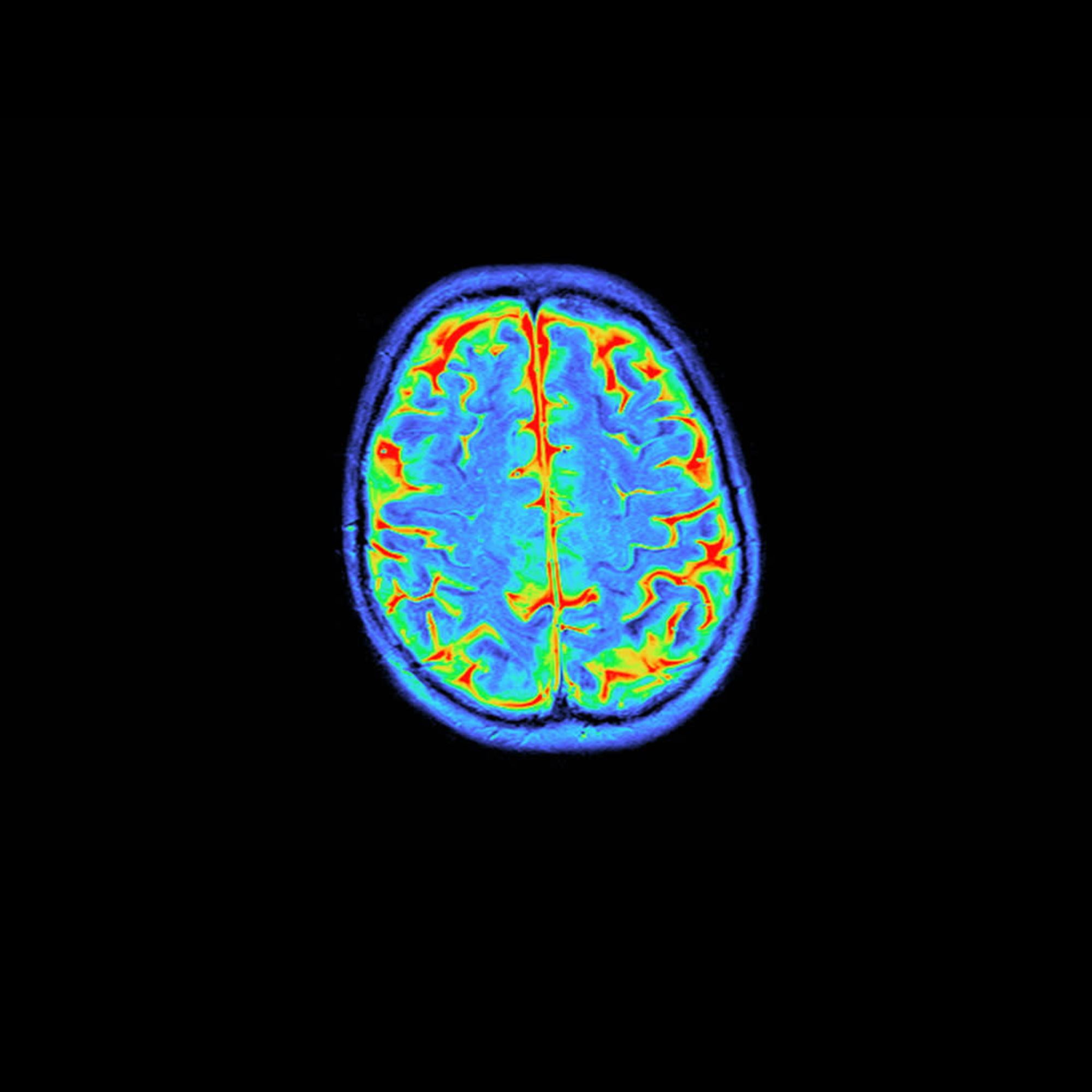 Colour brain scan image