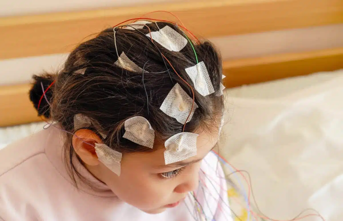 Patient undergoing an EEG recording