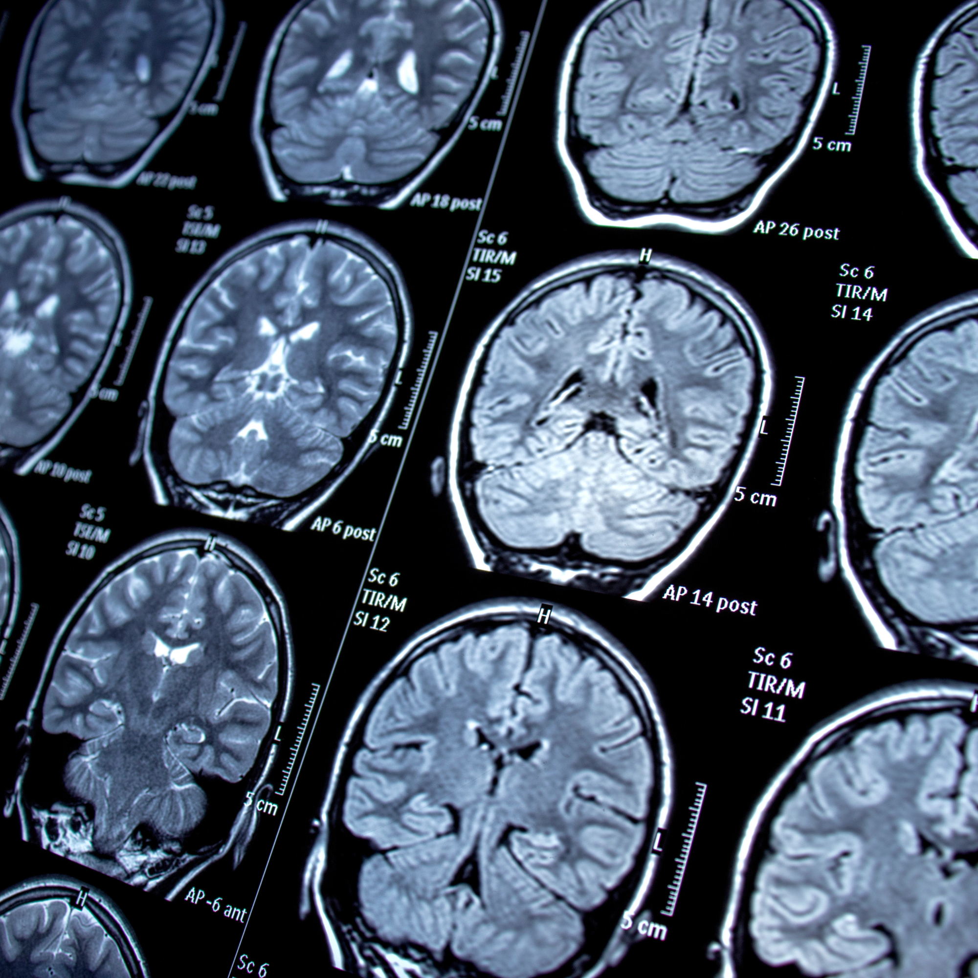 Diagnostic technology used in clinical neurophysiology
